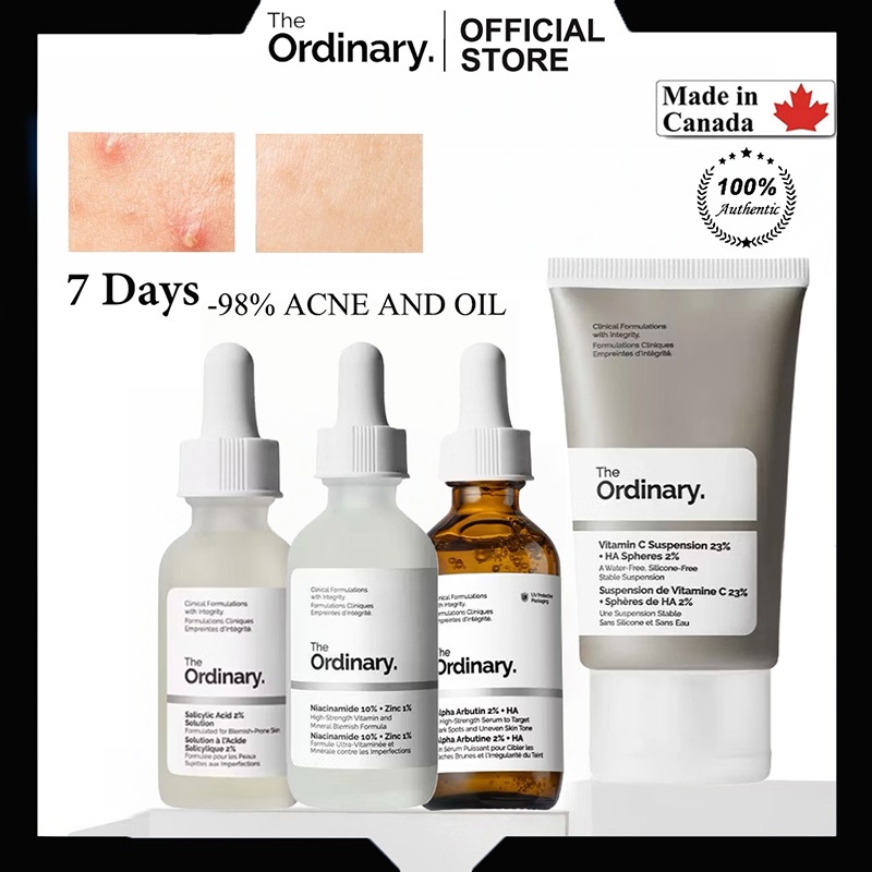 Adakah The Ordinary Set Niacinamide 10% + Zinc 1% Pilihan Tepat untuk Kulit Berminyak?
